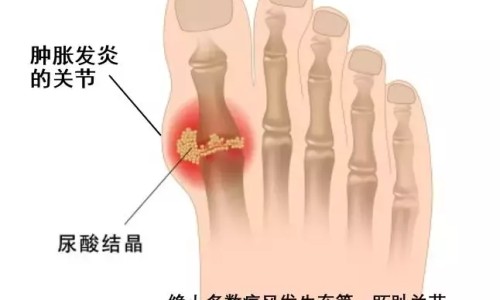 糖尿病人怎样补充糖类-【糖尿病怎么才能补充营养增加血糖】糖尿病人怎么补糖 - 糖尿病人怎样补充糖网